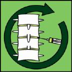 Continu epiduraal infuus